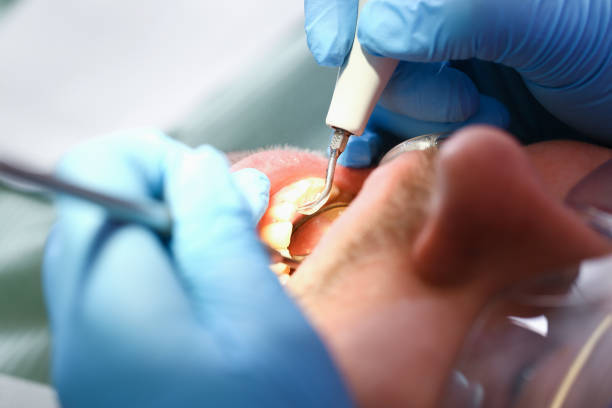 Best Urgent Dental Care for Toothache in The College Of New Jersey, NJ