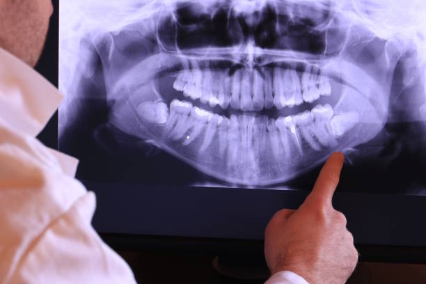 Best Emergency Dentist for Lost Fillings or Crowns in The College Of New Jersey, NJ